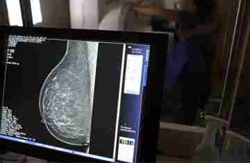  Nova lei reforça direito a três folgas por ano para exames preventivos 